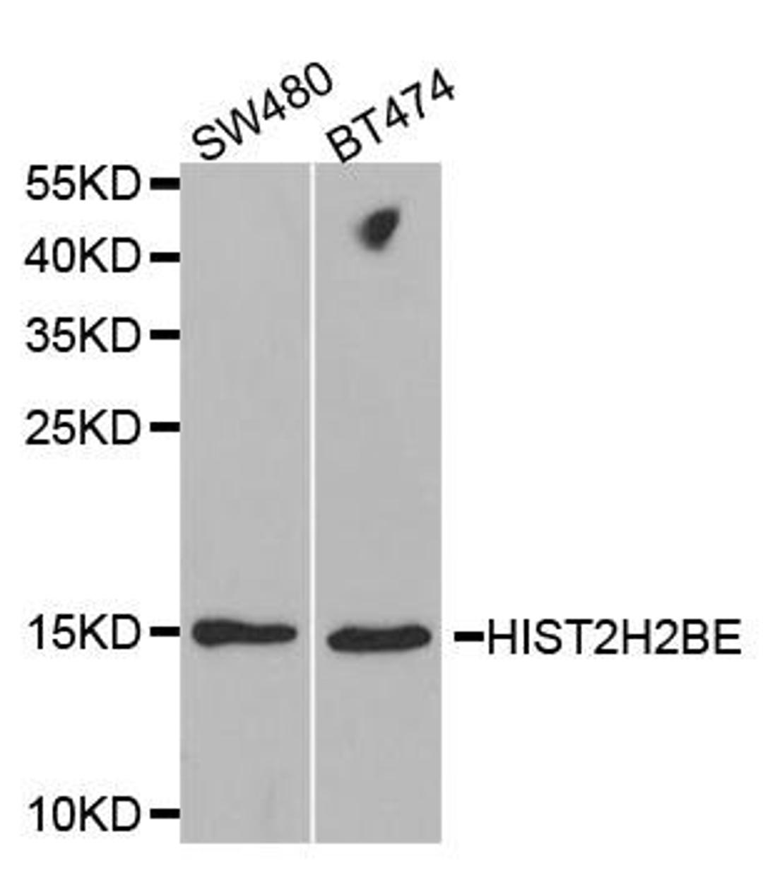 Western blot analysis of extracts of various cell lines using HIST2H2BE antibody