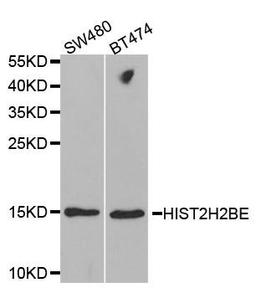 Western blot analysis of extracts of various cell lines using HIST2H2BE antibody