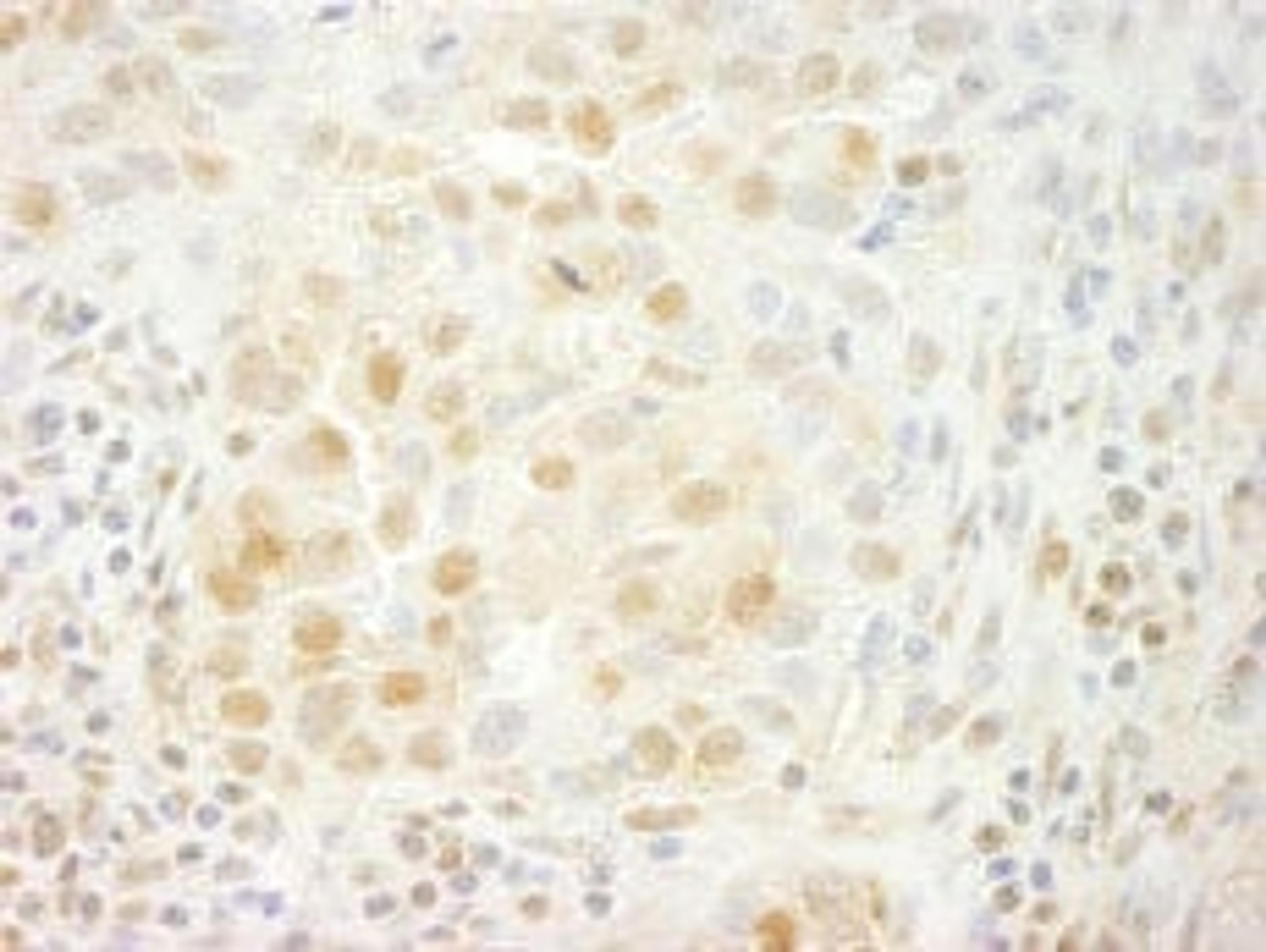 Detection of human PRPF4B by immunohistochemistry.