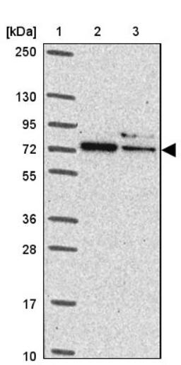 Western Blot: SAH3 Antibody [NBP2-47293] - Lane 1: Marker [kDa] 250, 130, 95, 72, 55, 36, 28, 17, 10.  Lane 2: Human cell line RT-4.  Lane 3: Human cell line U-251MG.