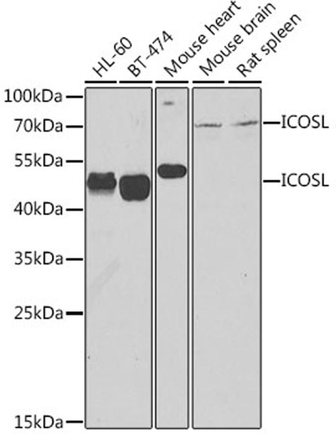 Western blot - ICOSL antibody (A7080)