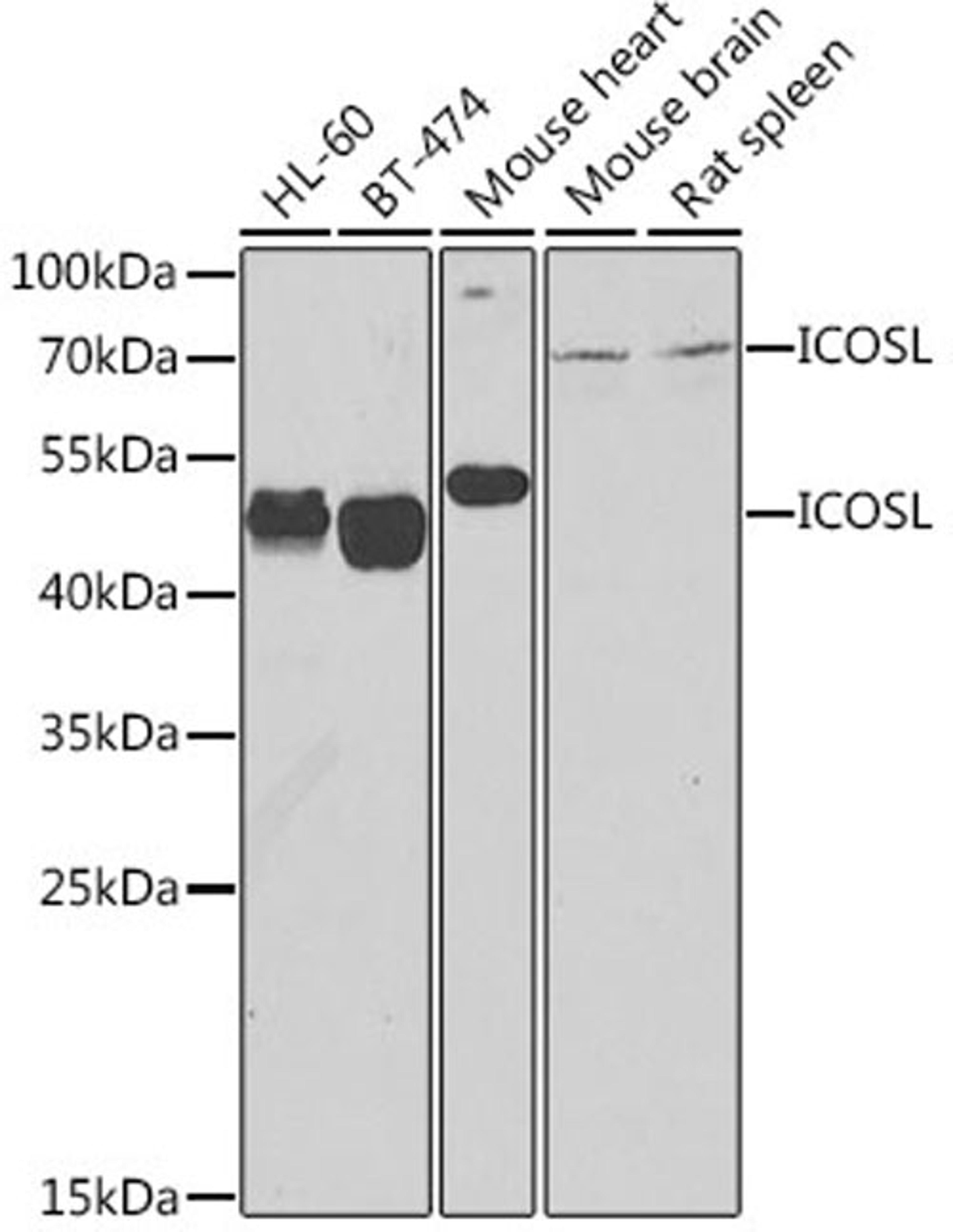 Western blot - ICOSL antibody (A7080)