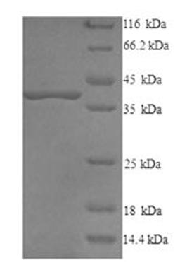 (Tris-Glycine gel) Discontinuous SDS-PAGE (reduced) with 5% enrichment gel and 15% separation gel.