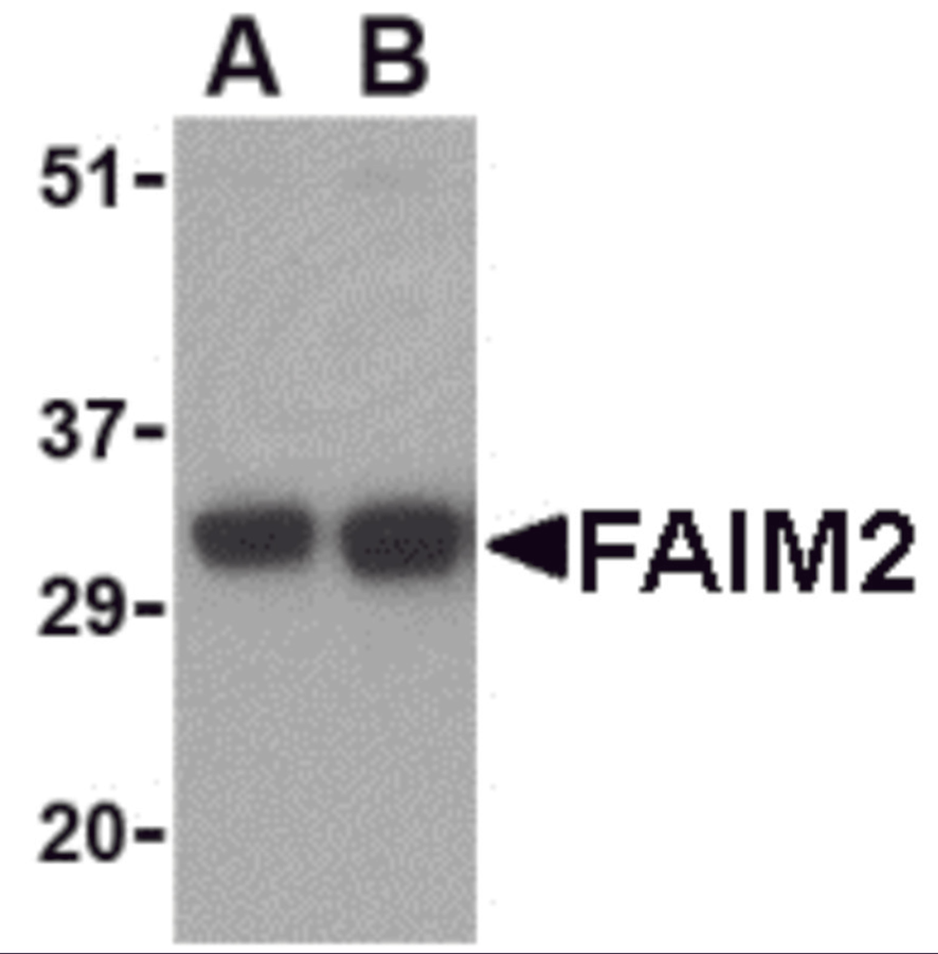 Western blot analysis of FAIM2 in EL4 cell lysate with FAIM2 antibody at (A) 0.5 and (B) 1 &#956;g/mL. 