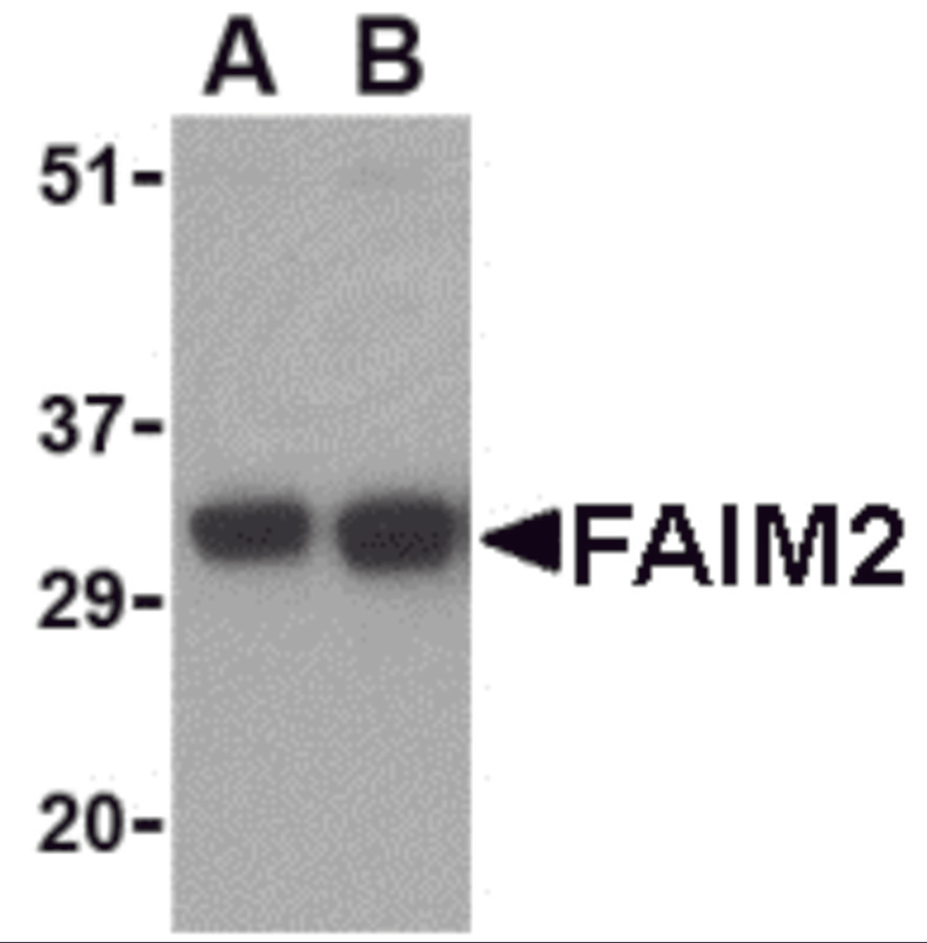 Western blot analysis of FAIM2 in EL4 cell lysate with FAIM2 antibody at (A) 0.5 and (B) 1 μg/mL.