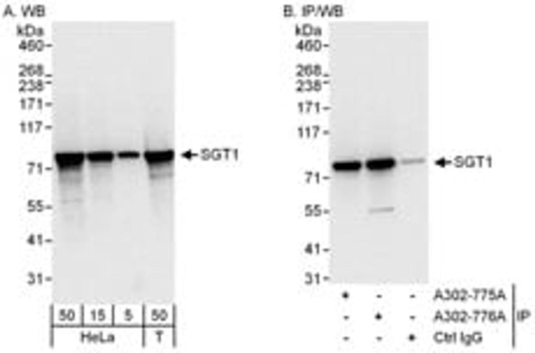 Detection of human SGT1 by western blot and immunoprecipitation.