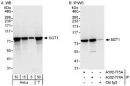 Detection of human SGT1 by western blot and immunoprecipitation.