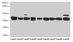 Western blot. All lanes: DNAJB1 antibody at 3µg/ml. Lane 1: Mouse spleen tissue. Lane 2: Colo320 whole cell lysate. Lane 3: Hela whole cell lysate. Lane 4: LO2 whole cell lysate. Lane 5: HepG2 whole cell lysate. Lane 6: HT29 whole cell lysate. Lane 7: A549 whole cell lysate. Lane 8: Jurkat whole cell lysate. Lane 9: MCF-7 whole cell lysate. Secondary. Goat polyclonal to rabbit IgG at 1/10000 dilution. Predicted band size: 39, 28 kDa. Observed band size: 39 kDa