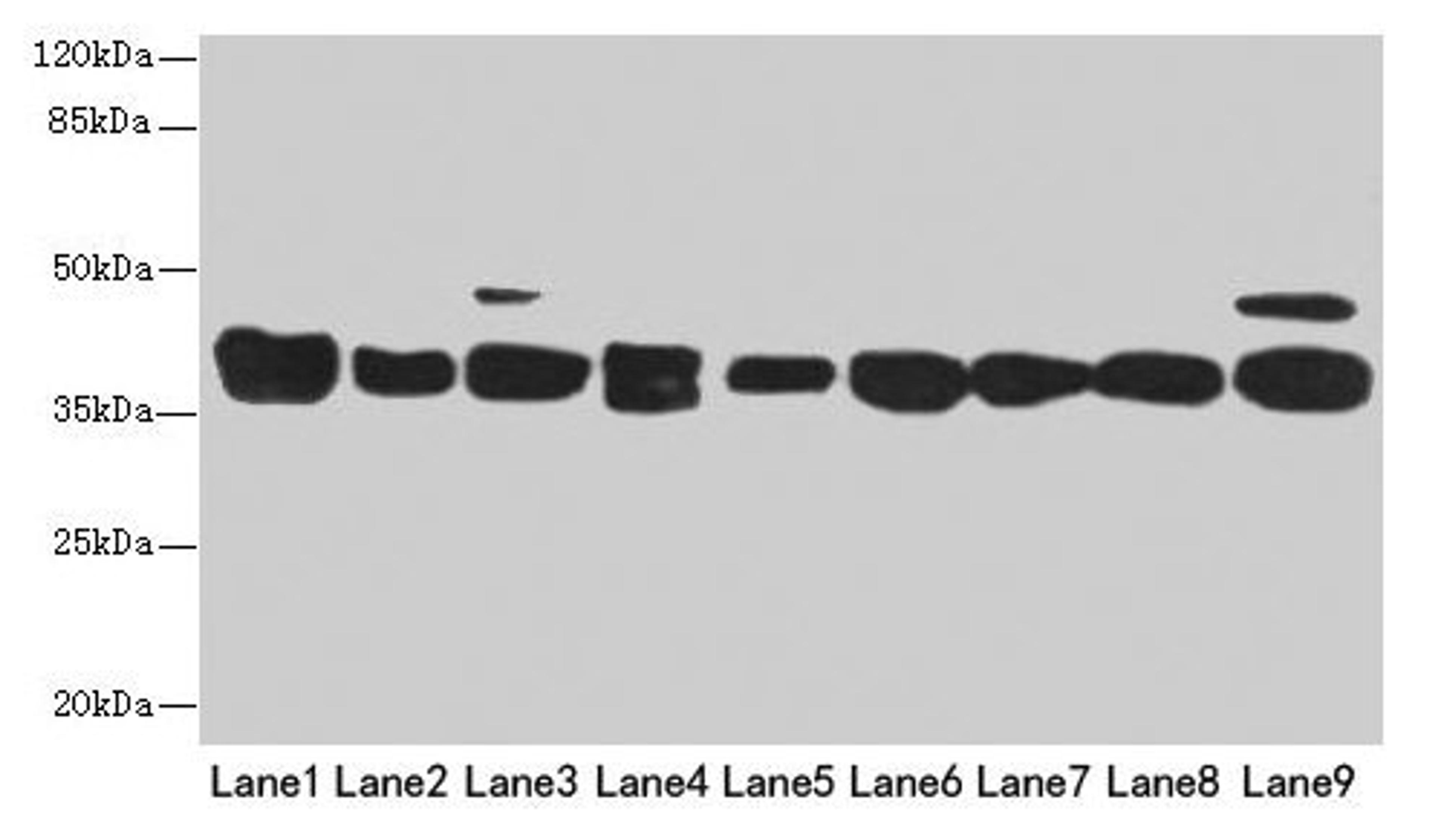 Western blot. All lanes: DNAJB1 antibody at 3µg/ml. Lane 1: Mouse spleen tissue. Lane 2: Colo320 whole cell lysate. Lane 3: Hela whole cell lysate. Lane 4: LO2 whole cell lysate. Lane 5: HepG2 whole cell lysate. Lane 6: HT29 whole cell lysate. Lane 7: A549 whole cell lysate. Lane 8: Jurkat whole cell lysate. Lane 9: MCF-7 whole cell lysate. Secondary. Goat polyclonal to rabbit IgG at 1/10000 dilution. Predicted band size: 39, 28 kDa. Observed band size: 39 kDa