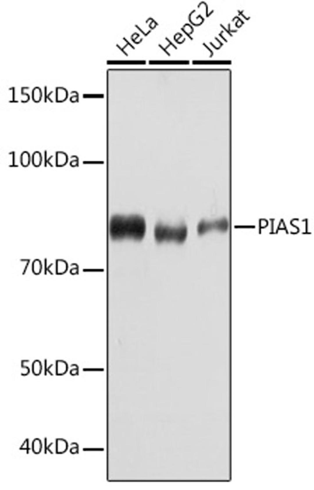 Western blot - PIAS1 Rabbit mAb (A4744)