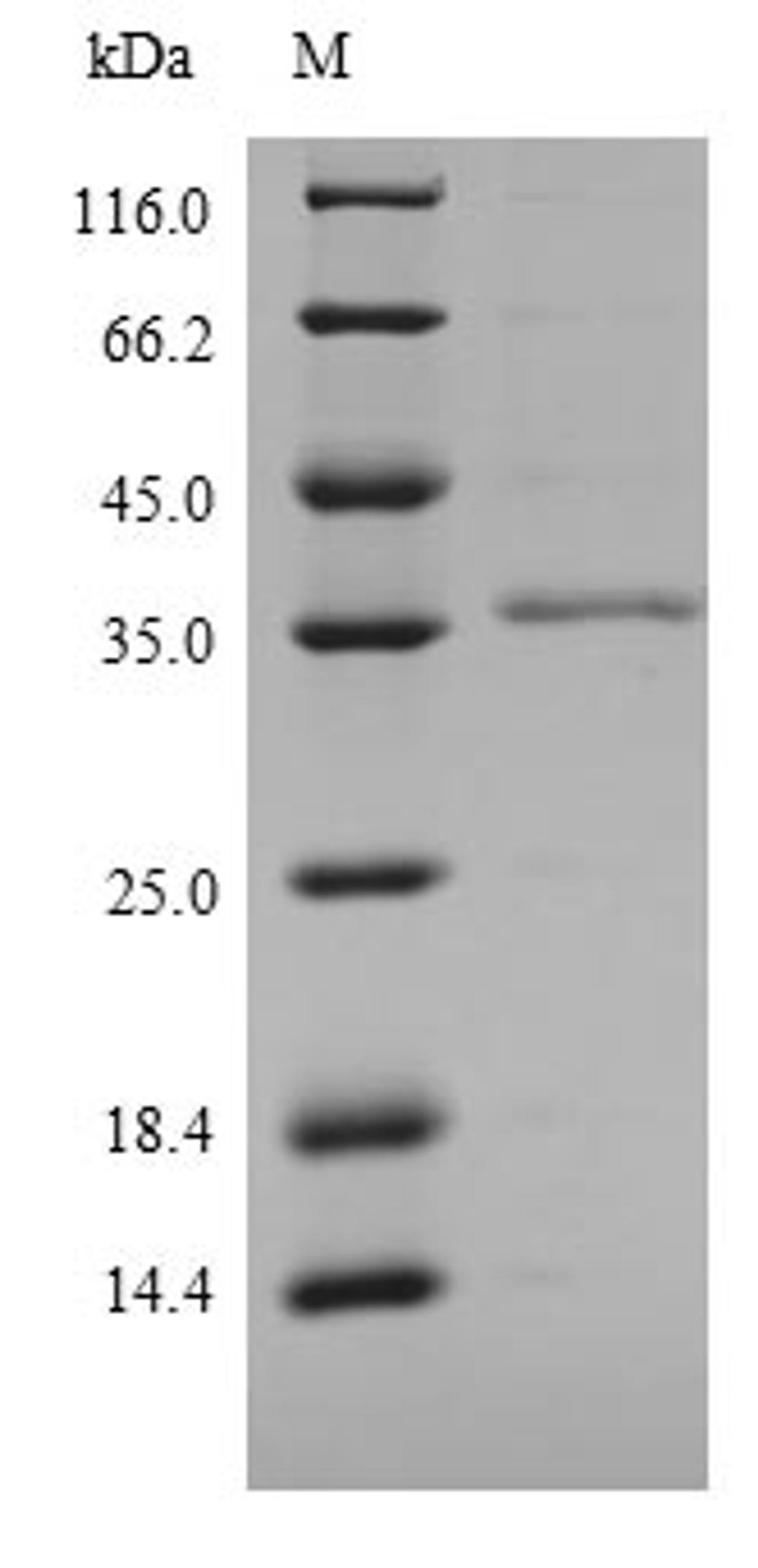 (Tris-Glycine gel) Discontinuous SDS-PAGE (reduced) with 5% enrichment gel and 15% separation gel.
