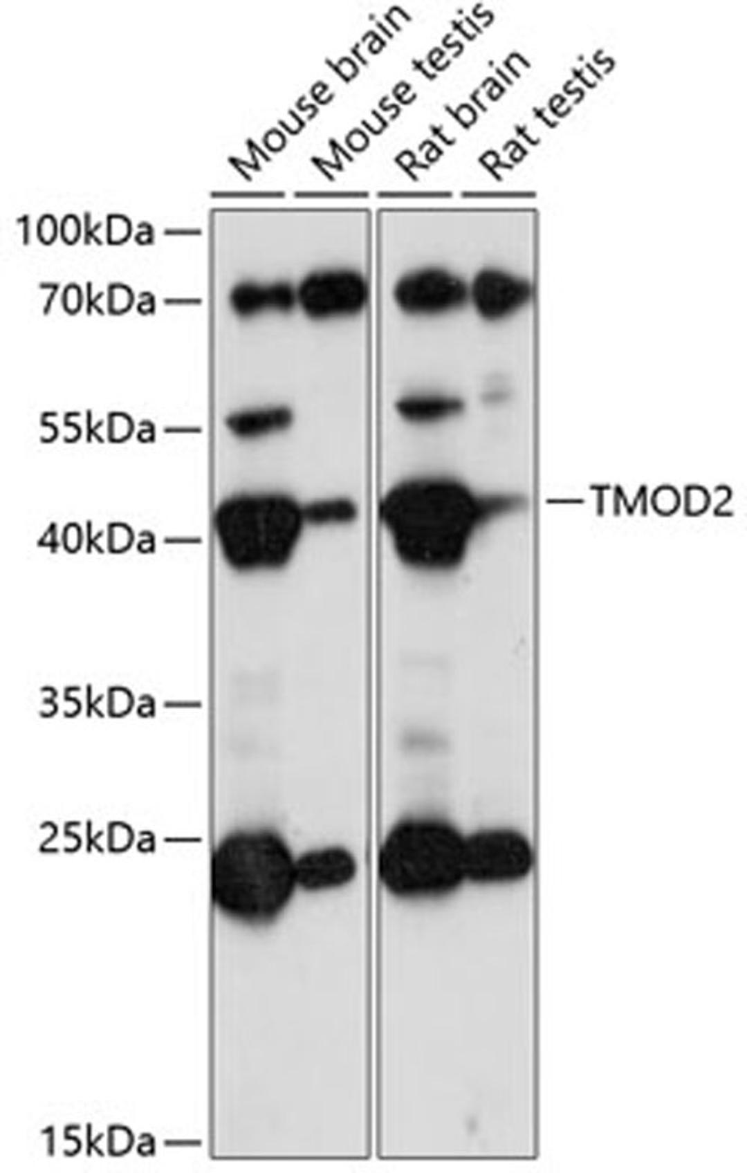 Western blot - TMOD2 antibody (A14881)