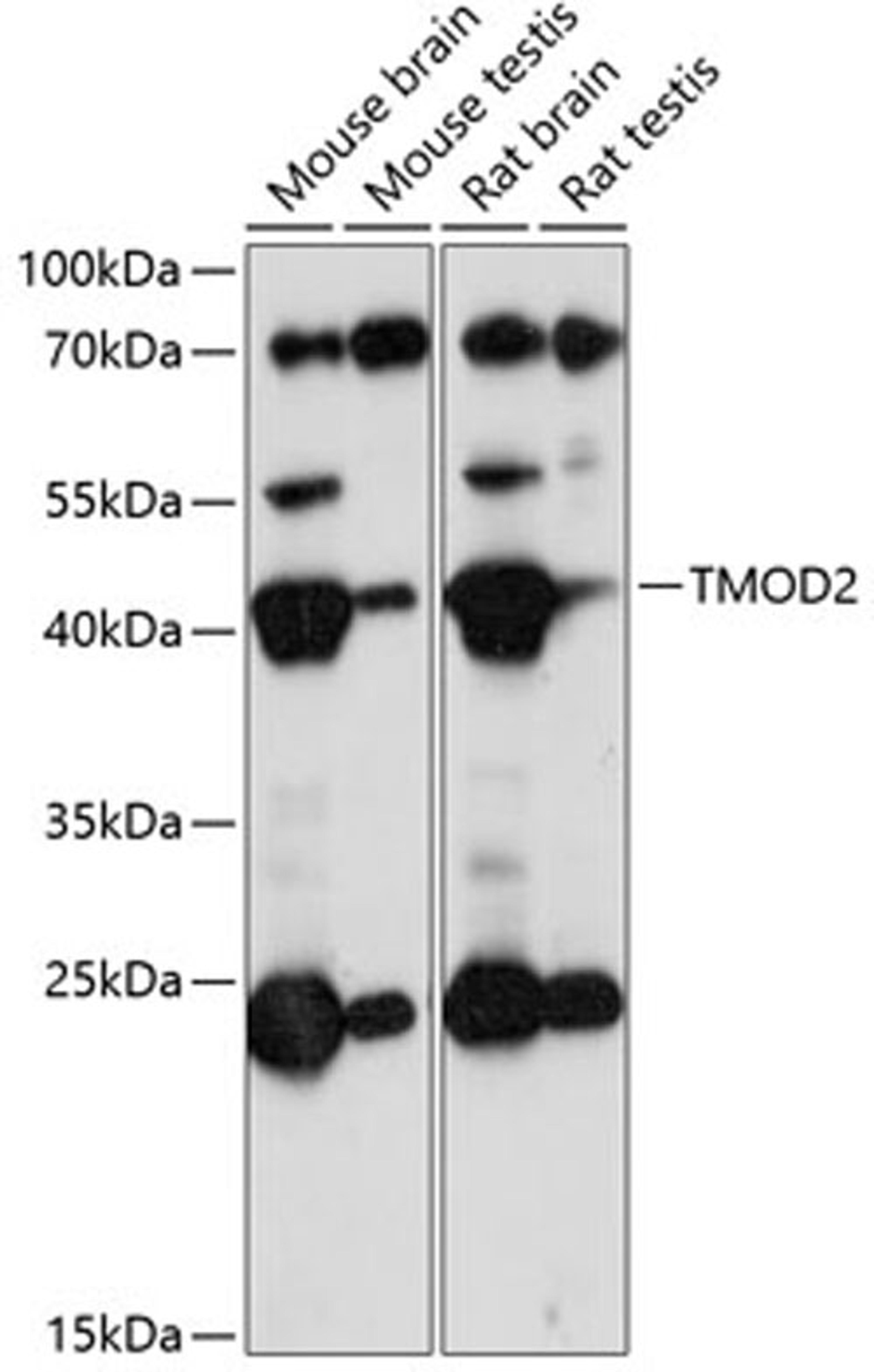 Western blot - TMOD2 antibody (A14881)