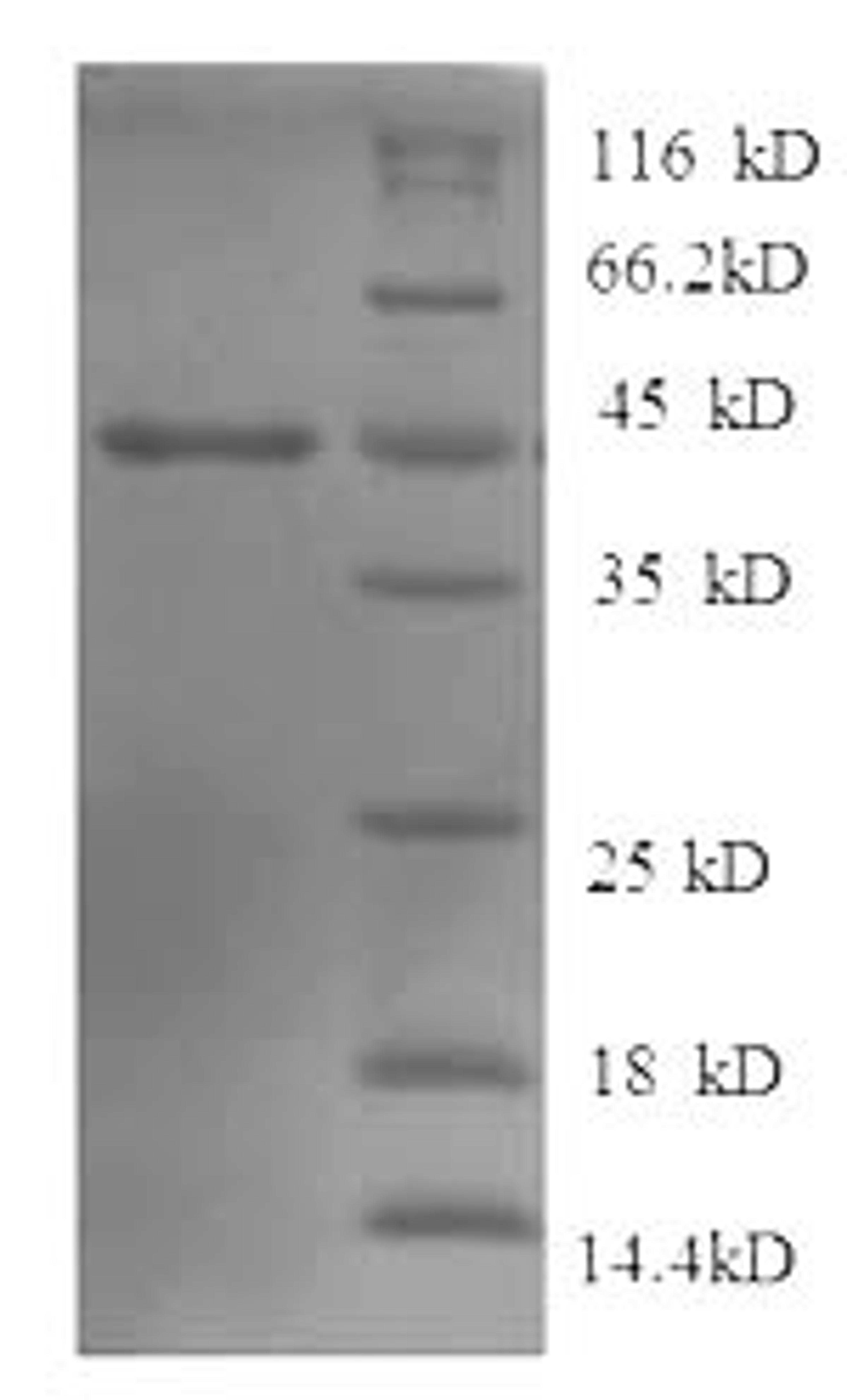 (Tris-Glycine gel) Discontinuous SDS-PAGE (reduced) with 5% enrichment gel and 15% separation gel.