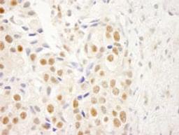 Detection of human NRBF2 by immunohistochemistry.