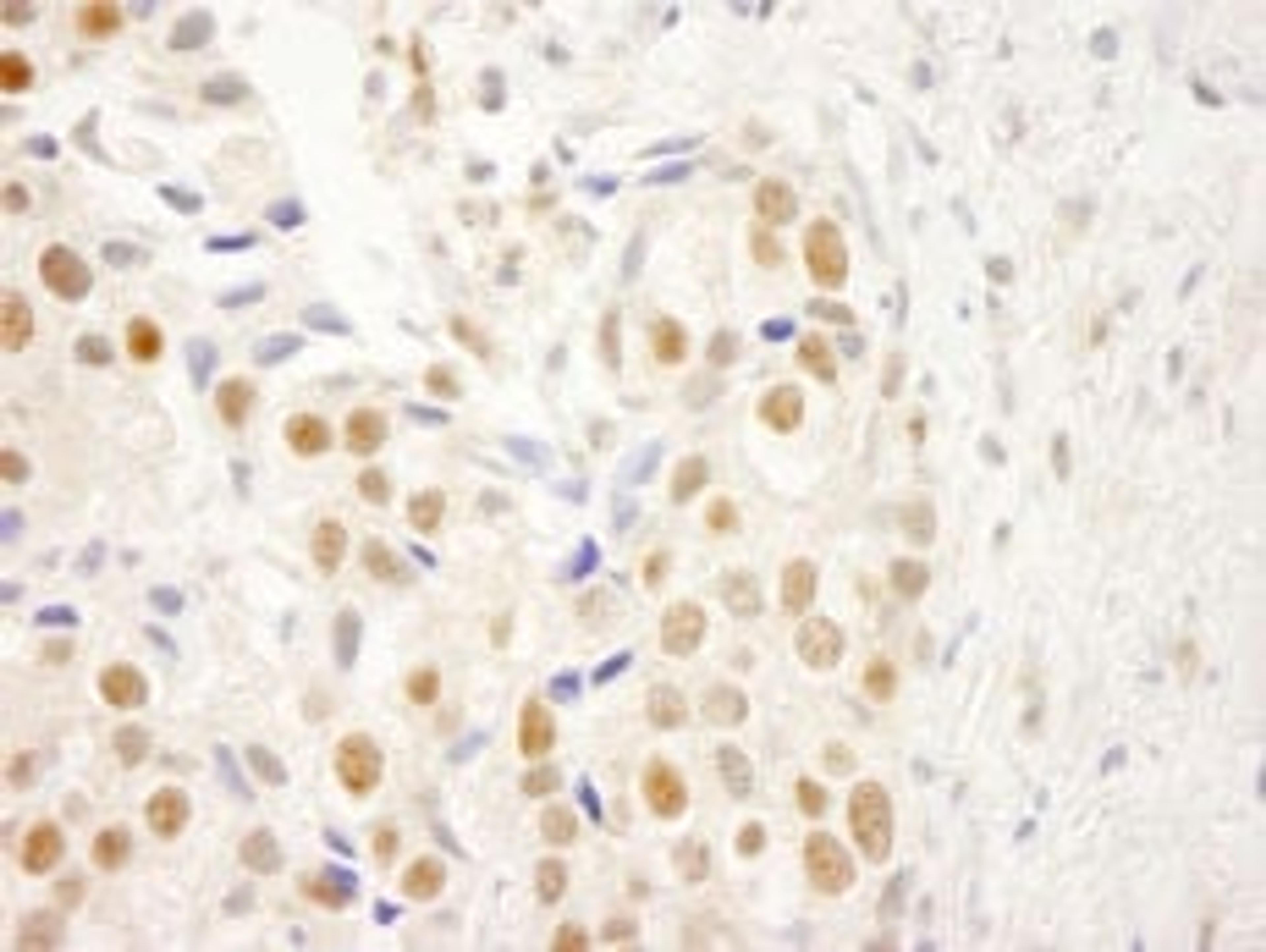 Detection of human NRBF2 by immunohistochemistry.