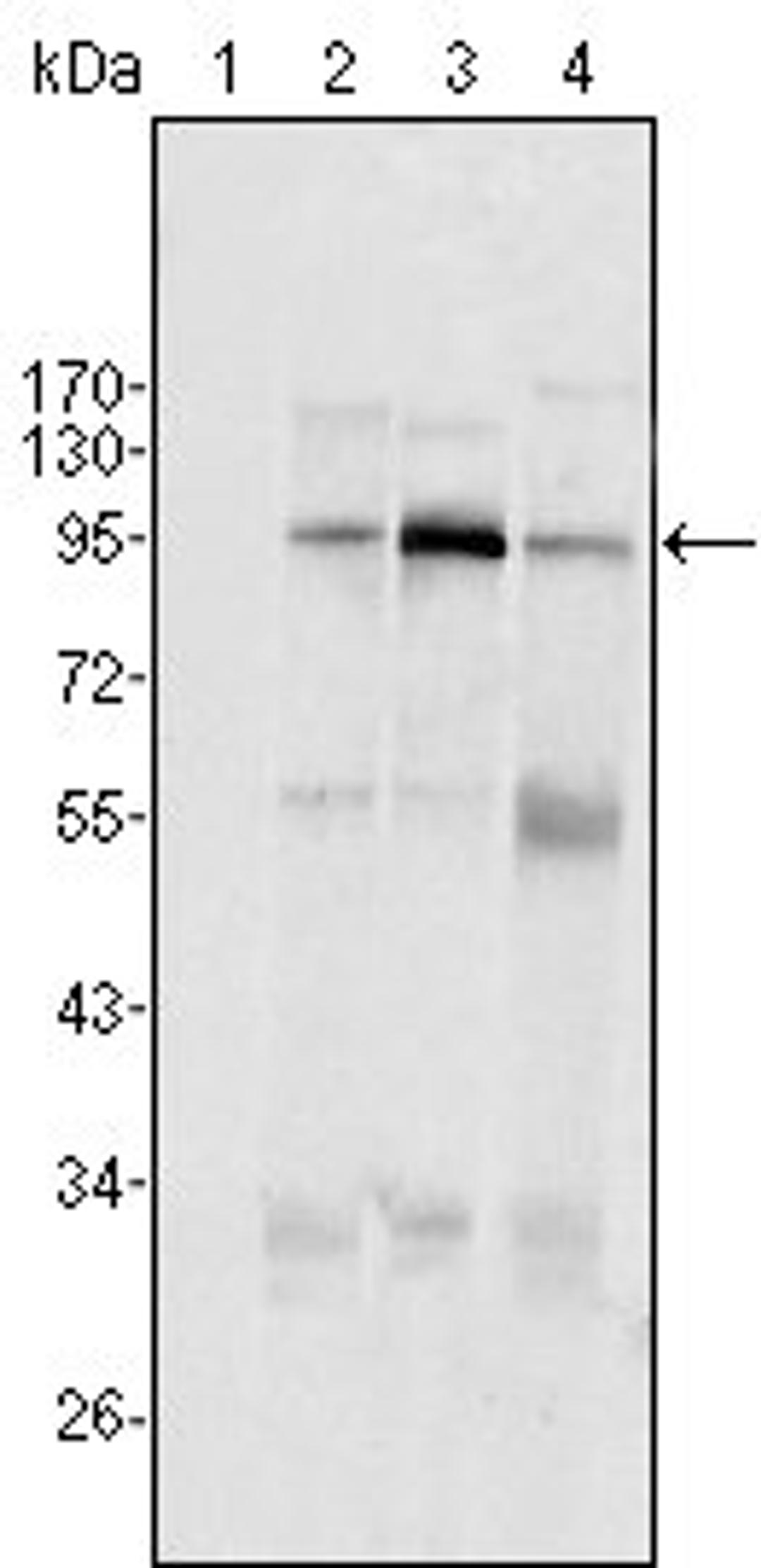 Western blot analysis of Hela (Lane1), Jukat (Lane2), HepG2 (Lane3) SMMC-7721 (Lane4) cell lysate using SND1/P100 antibody