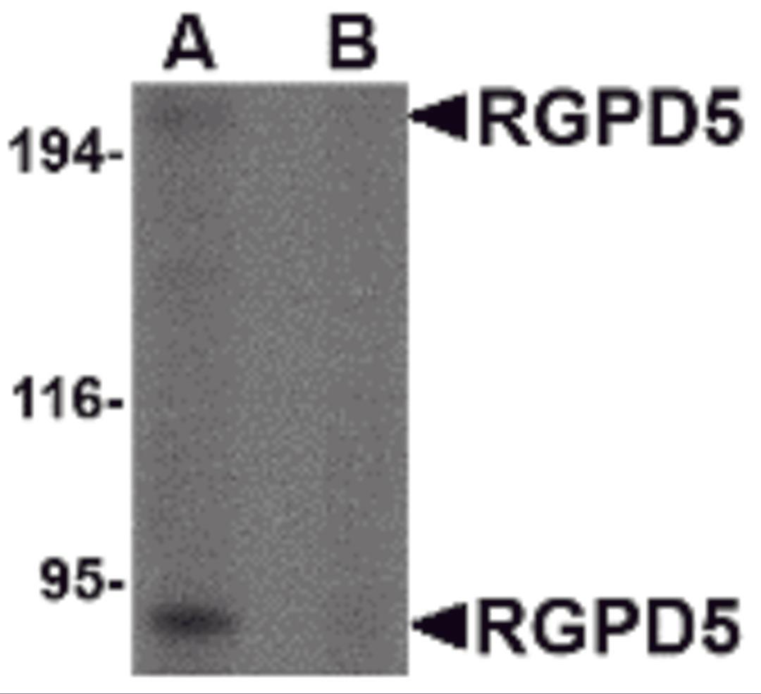 Western blot analysis of RGPD5 in human thymus tissue lysate with RGPD5 antibody at 1 μg/mL in (A) the absence and (B) the presense of blocking peptide.