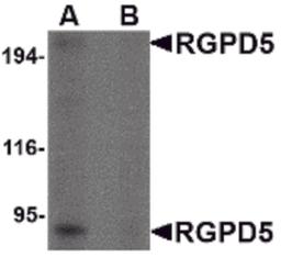 Western blot analysis of RGPD5 in human thymus tissue lysate with RGPD5 antibody at 1 μg/mL in (A) the absence and (B) the presense of blocking peptide.