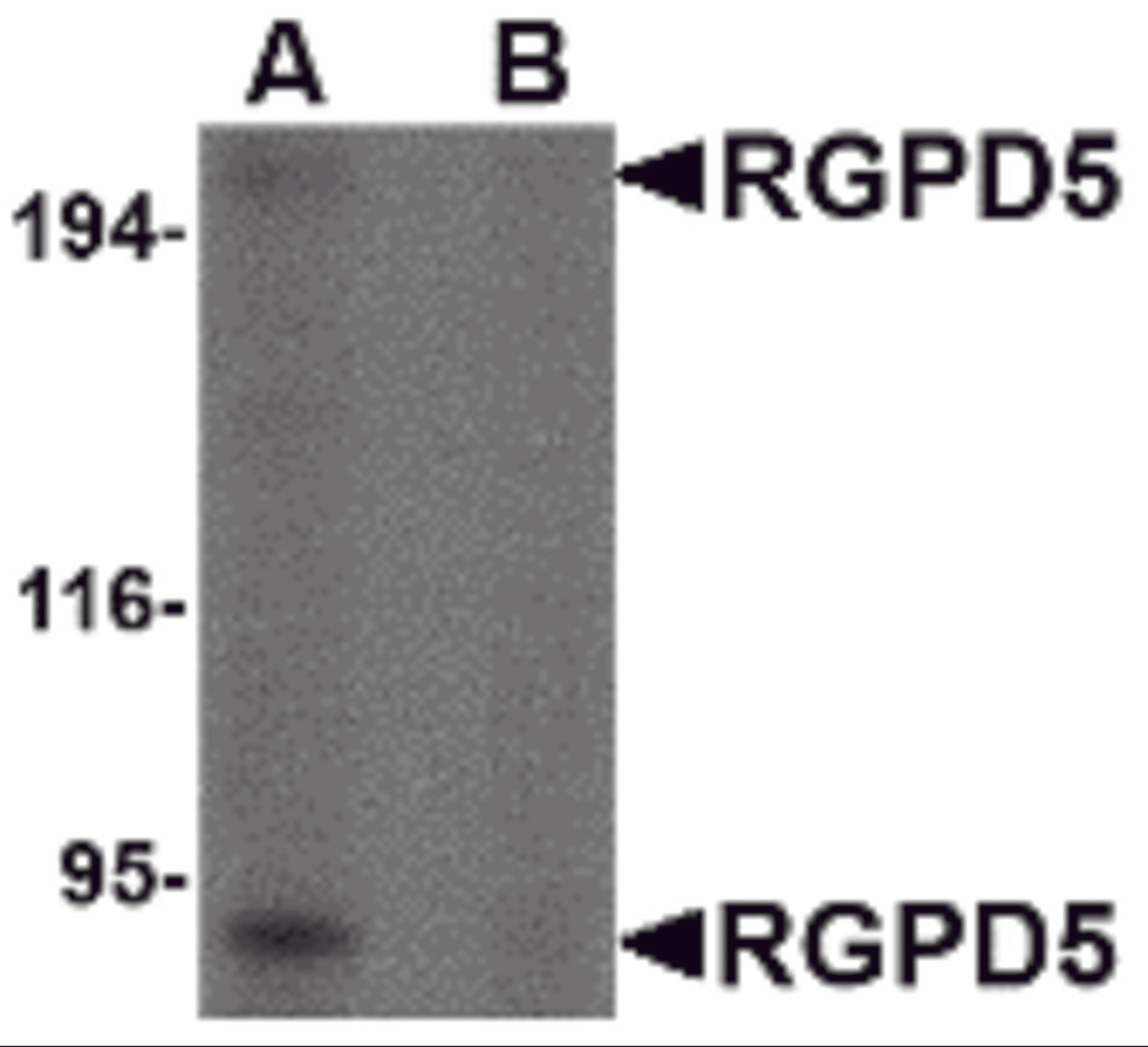 Western blot analysis of RGPD5 in human thymus tissue lysate with RGPD5 antibody at 1 μg/mL in (A) the absence and (B) the presense of blocking peptide.