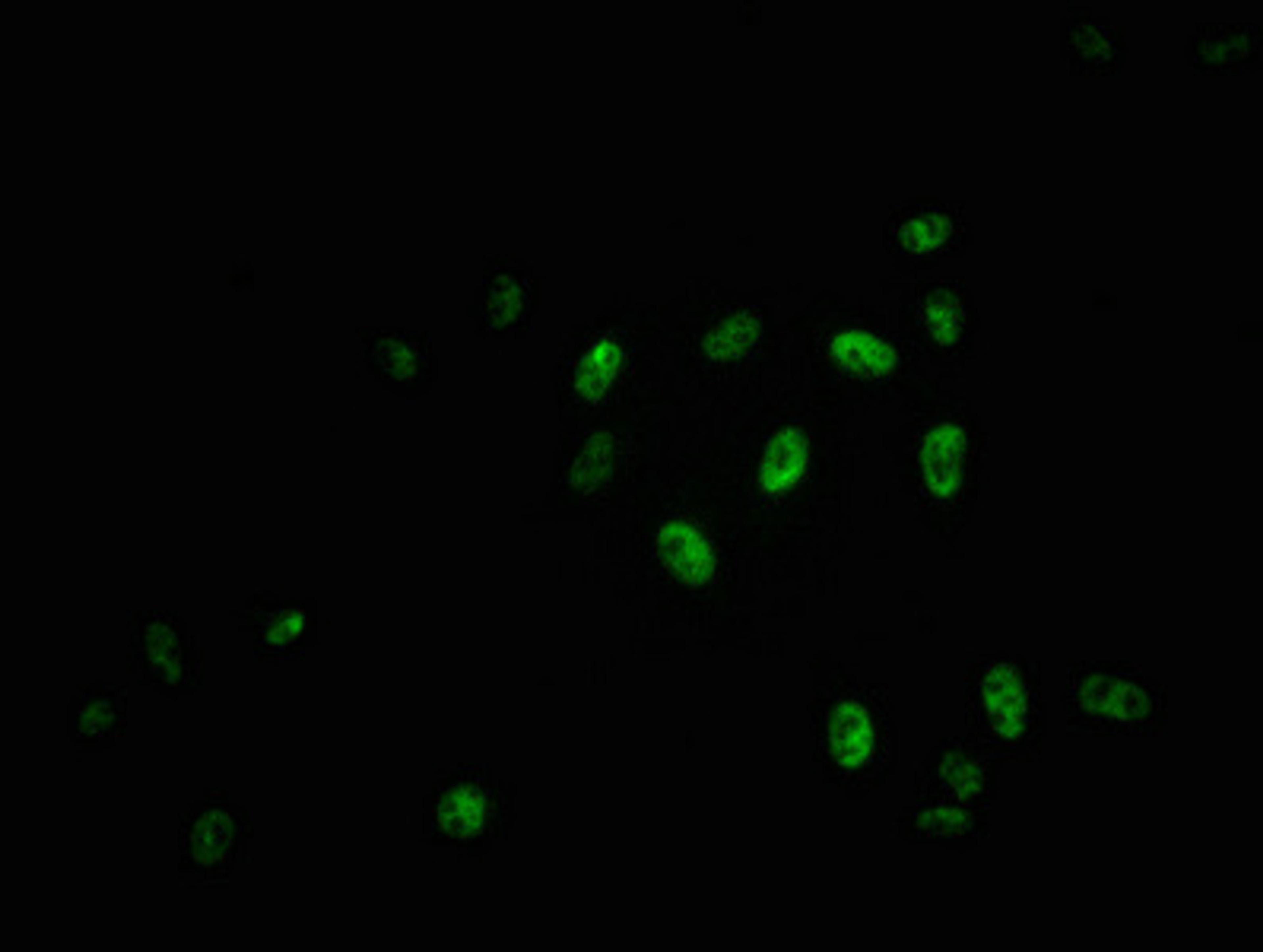 Immunofluorescence staining of Hela cells with CSB-RA015261A11phHU at 1:100,counter-stained with DAPI. The cells were fixed in 4% formaldehyde, permeabilized using 0.2% Triton X-100 and blocked in 10% normal Goat Serum. The cells were then incubated with the antibody overnight at 4℃. The secondary antibody was Alexa Fluor 488-congugated AffiniPure Goat Anti-Rabbit IgG (H+L).