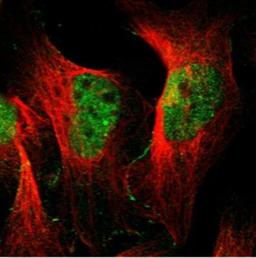 Immunofluorescence: DEP-1/CD148 Antibody [NBP1-86547] - Staining of human cell line U-2 OS shows positivity in plasma membrane & nucleus but excluded from the nucleoli. Antibody staining is shown in green.