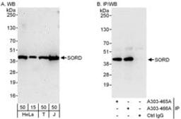 Detection of human SORD by western blot and immunoprecipitation.