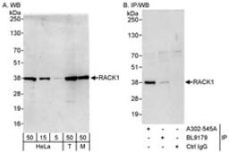 Detection of human and mouse RACK1 by western blot (h&m) and immunoprecipitation (h).