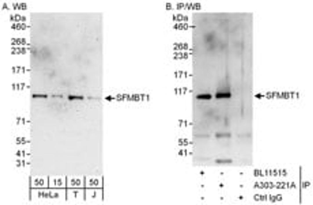 Detection of human SFMBT1 by western blot and immunoprecipitation.