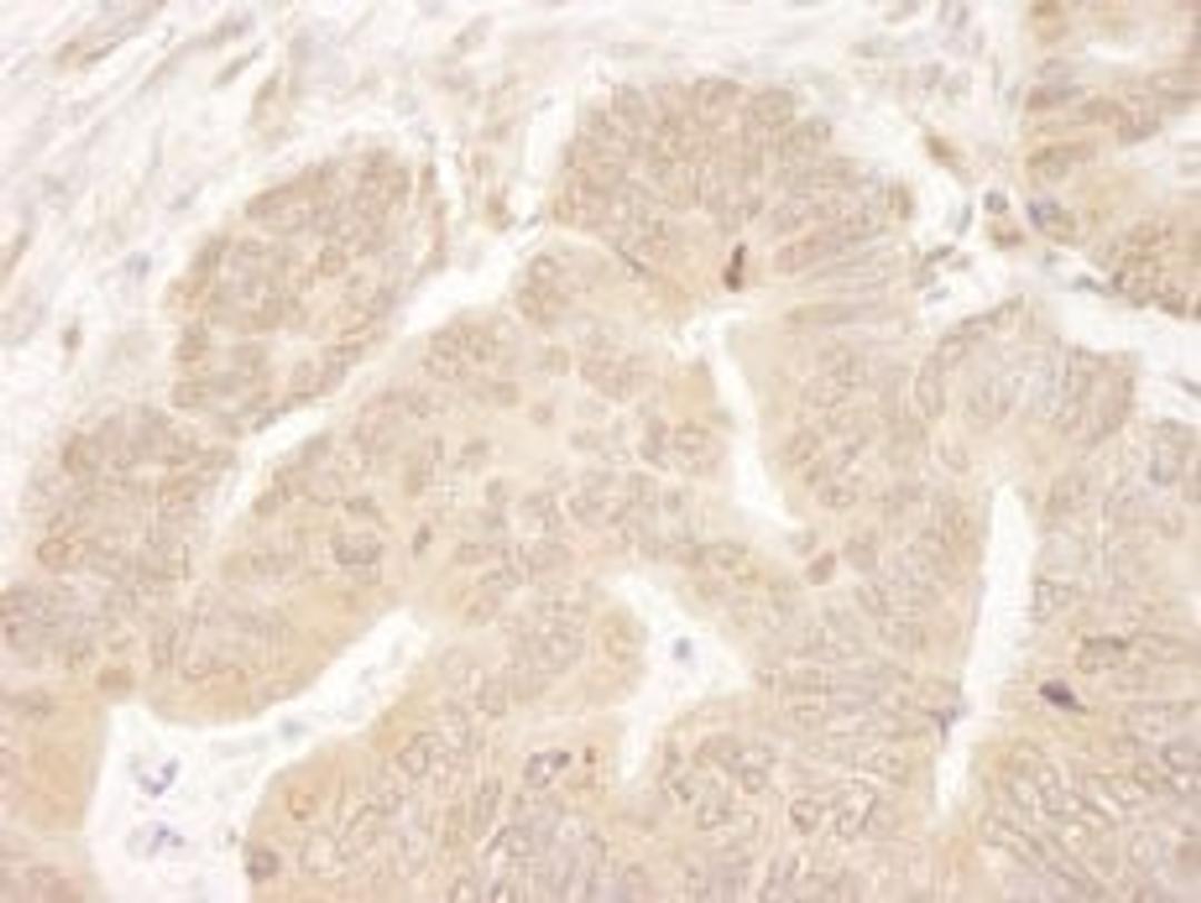 Detection of human MCAK by immunohistochemistry.