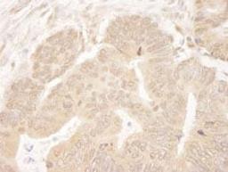 Detection of human MCAK by immunohistochemistry.