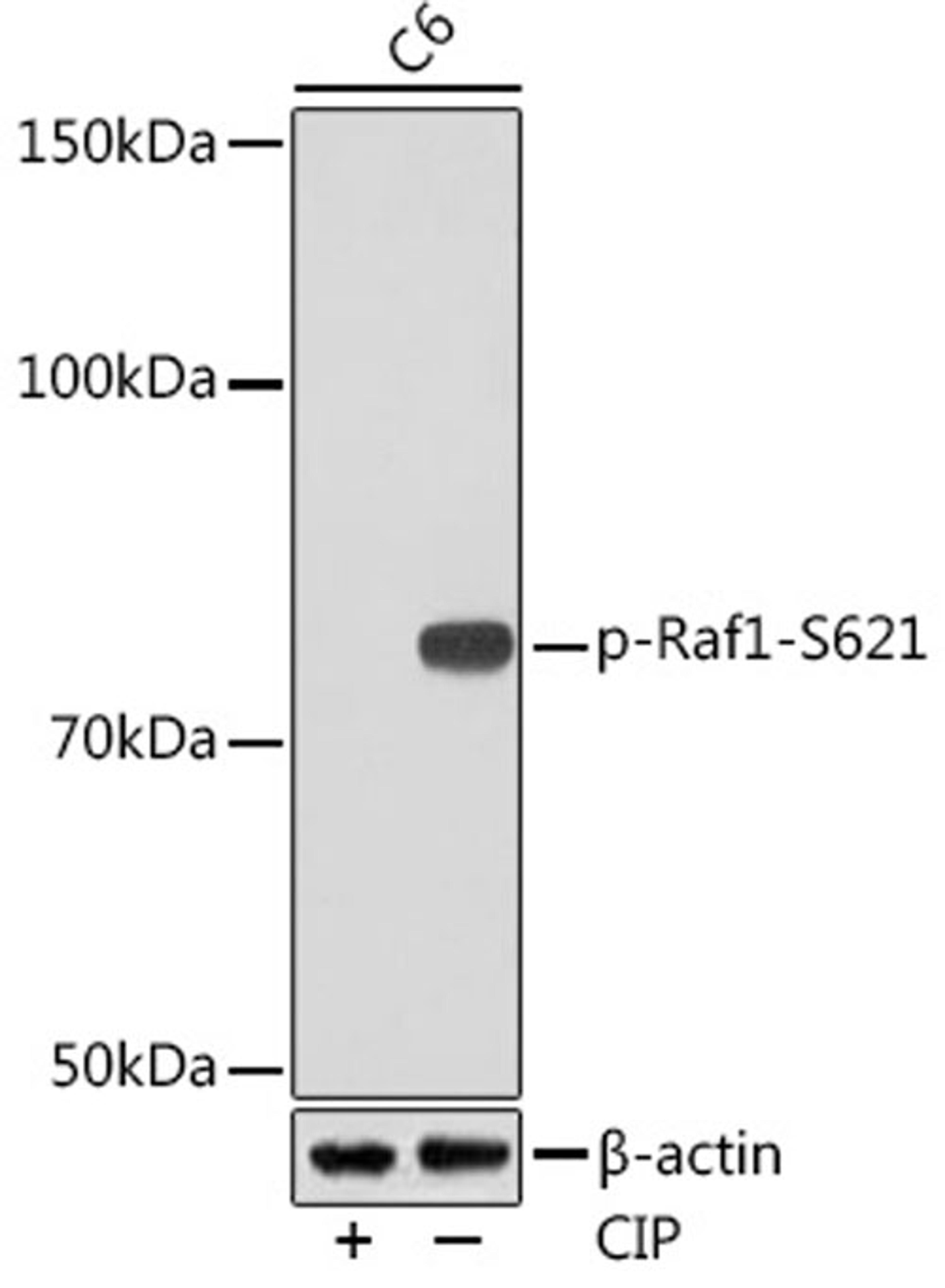 Western blot - Phospho-Raf1-S621 Rabbit mAb (AP1011)