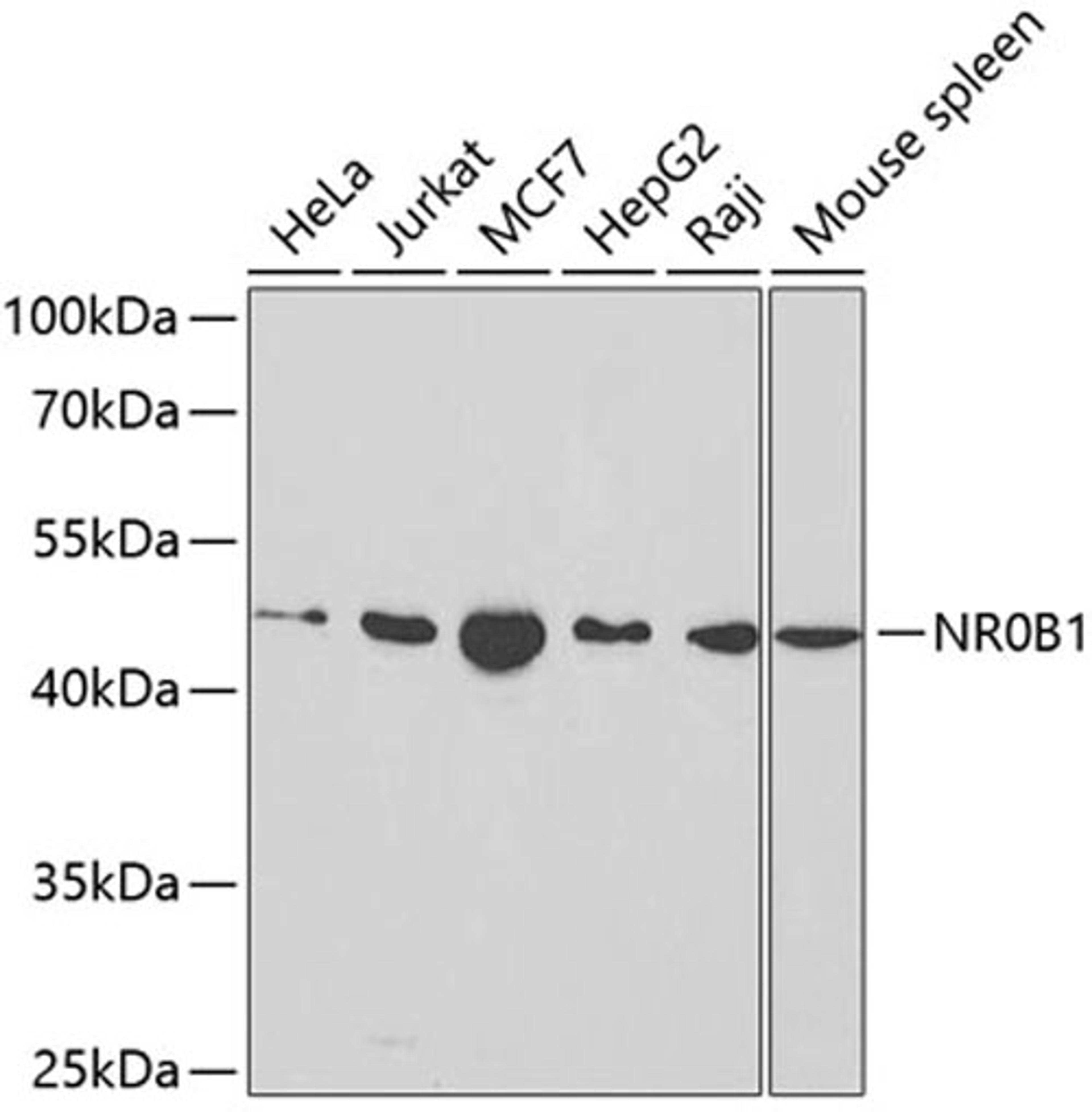 Western blot - NR0B1 antibody (A1740)