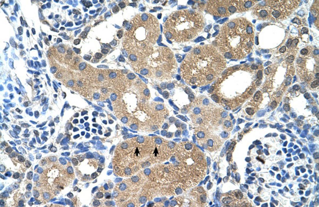 Antibody used in IHC on Human kidney.