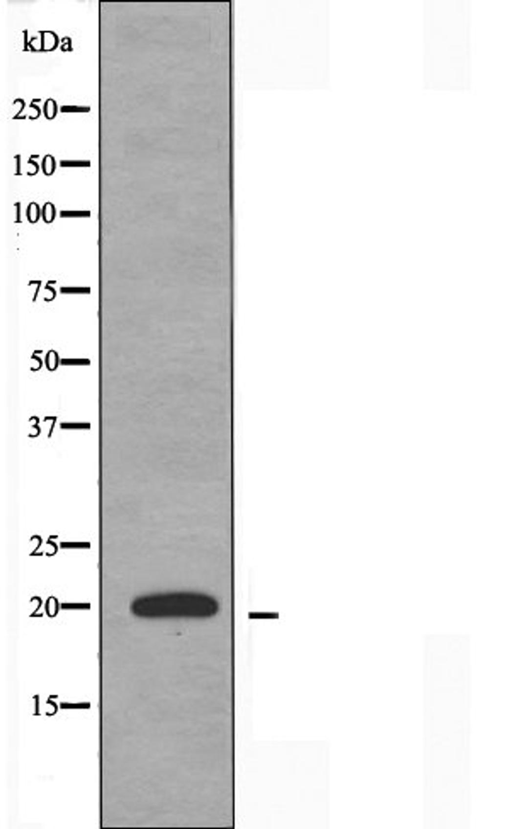 Western blot analysis of HUVEC cells using TNFAIP8L2 antibody