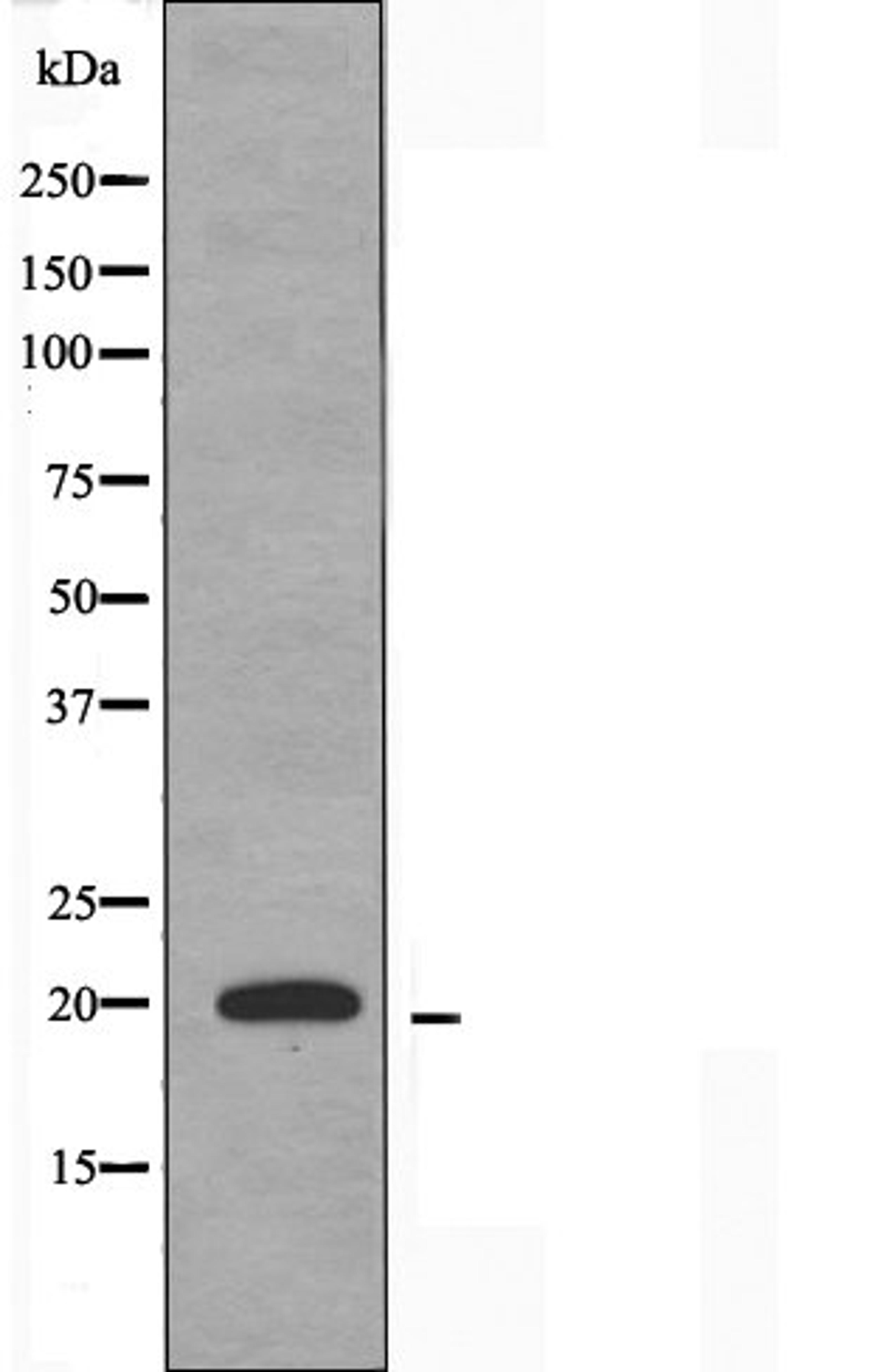 Western blot analysis of HUVEC cells using TNFAIP8L2 antibody