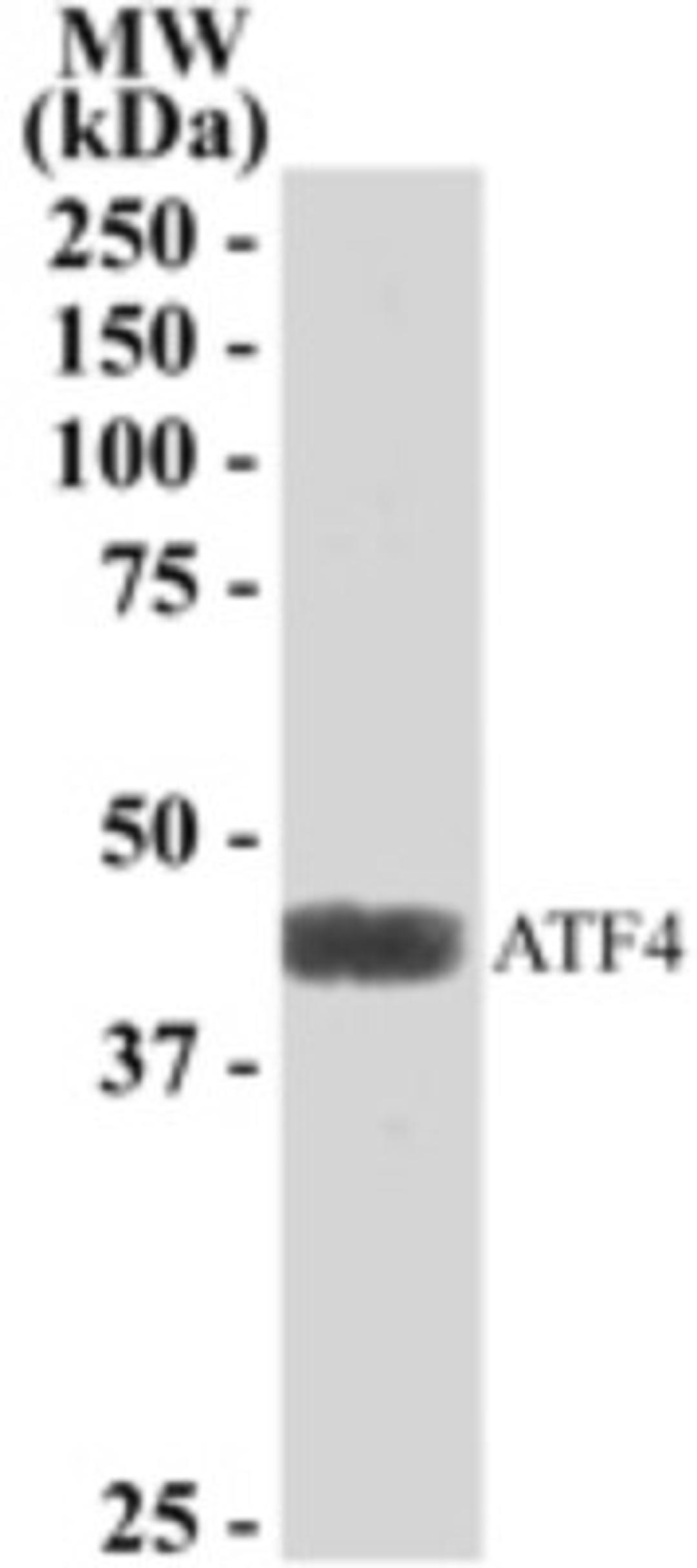 Western Blot: ATF4 Antibody [NB100-852] - ATF4 Antibody staining (1 ug/ml) of Raji lysate (RIPA buffer, 35 ug total protein per lane). Primary incubated for 1 hour. ATF4 antibody detected using chemiluminescence.