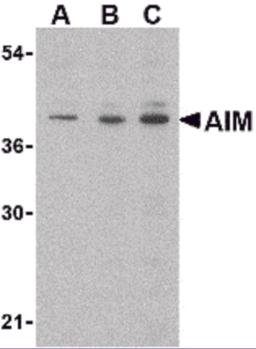 Western blot analysis of AIM in Raji lysate with AIM antibody at (A) 0.5, (B) 1 and (C) 2 &#956;g/mL.