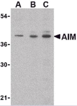 Western blot analysis of AIM in Raji lysate with AIM antibody at (A) 0.5, (B) 1 and (C) 2 μg/mL.