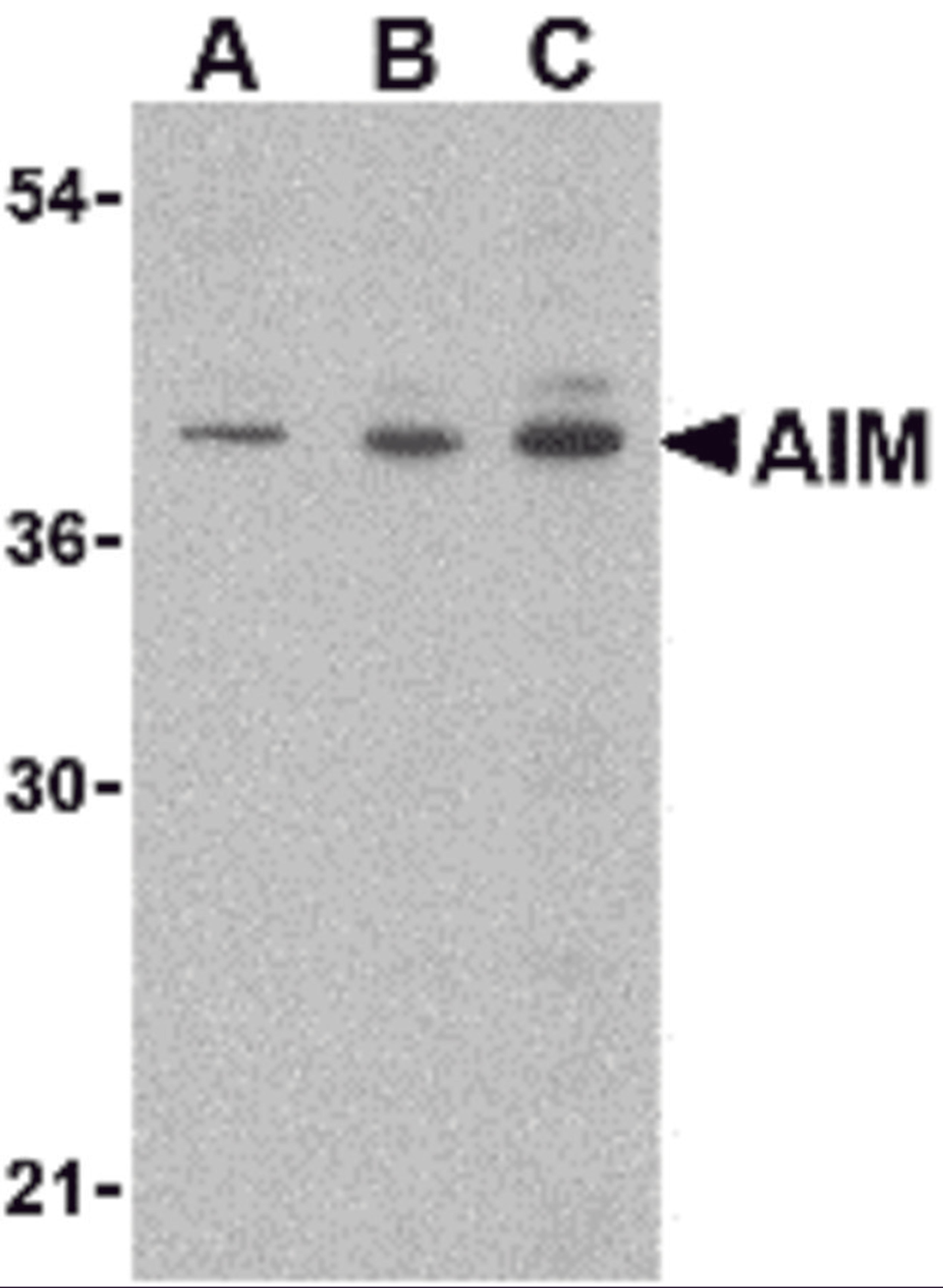 Western blot analysis of AIM in Raji lysate with AIM antibody at (A) 0.5, (B) 1 and (C) 2 μg/mL.