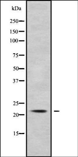 Western blot analysis of COS7 whole cell lysates using KCNMB1 antibody