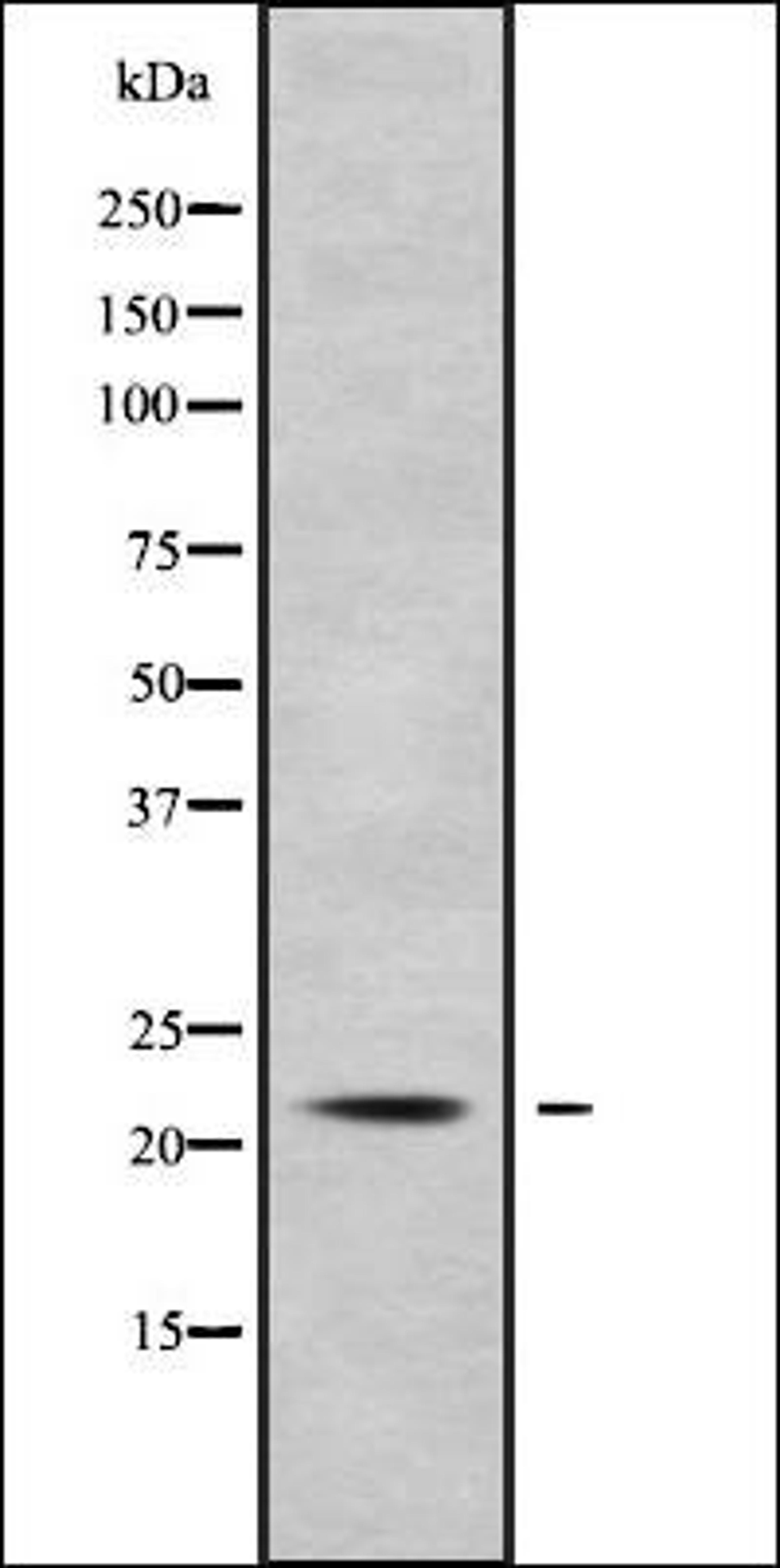 Western blot analysis of COS7 whole cell lysates using KCNMB1 antibody