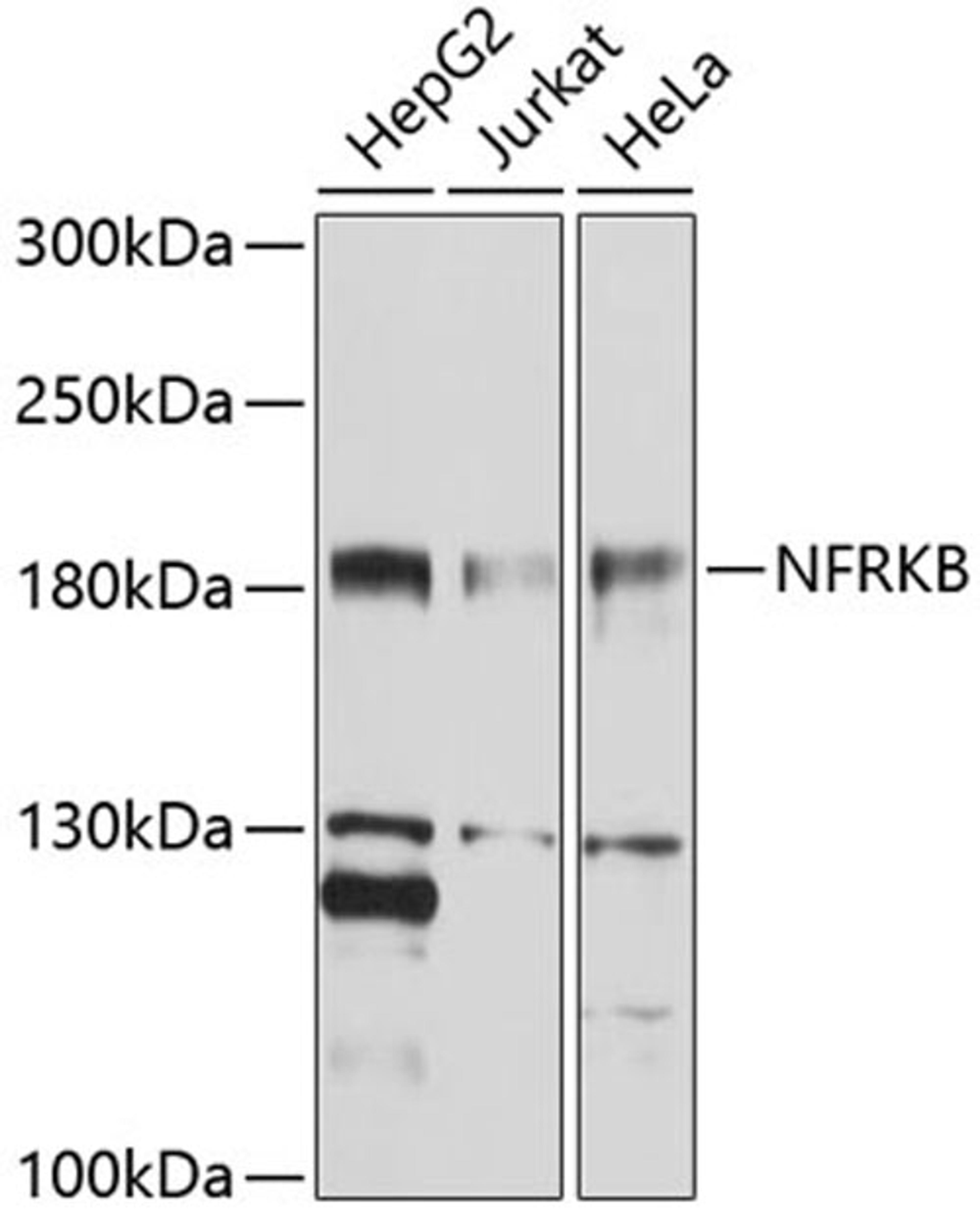 Western blot - NFRKB antibody (A10124)