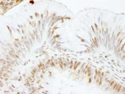 Detection of human USP47 by immunohistochemistry.