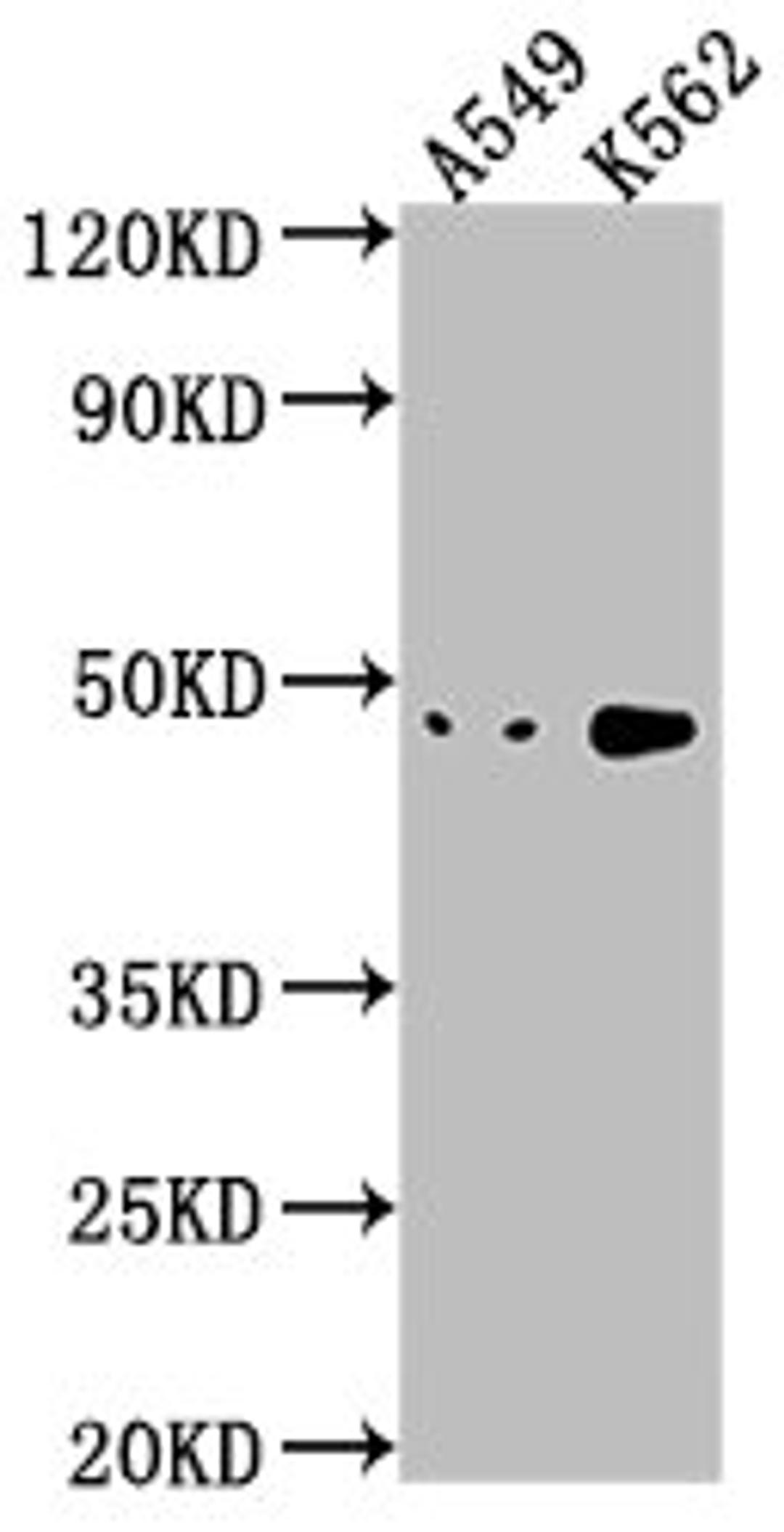 Western Blot. Positive WB detected in: A549 whole cell lysate, K562 whole cell lysate. All lanes: NKAPL antibody at 1:1000. Secondary. Goat polyclonal to rabbit IgG at 1/50000 dilution. Predicted band size: 47 kDa. Observed band size: 47 kDa.