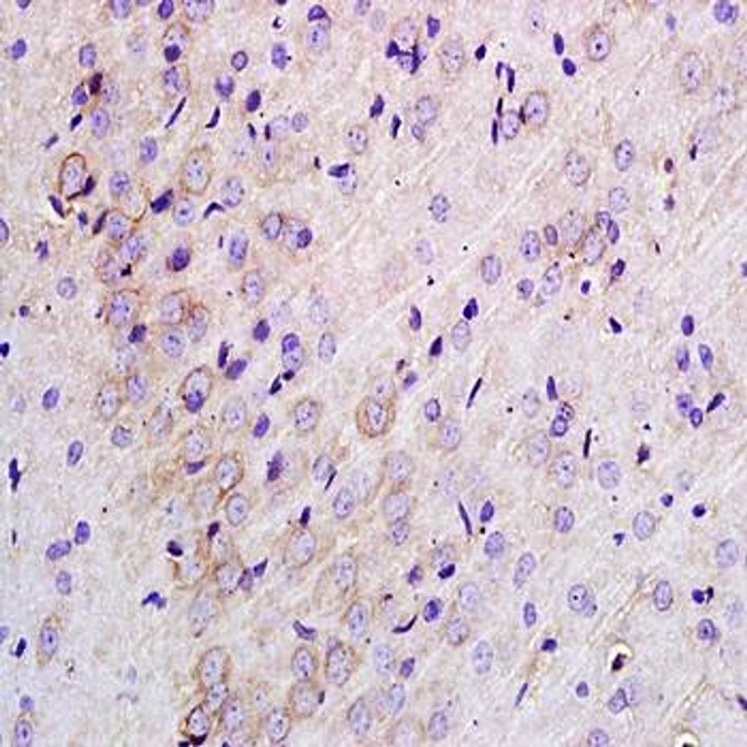 Immunohistochemical analysis of formalin-fixed and paraffin embedded rat brain tissue (dilution at:1:200) using TLR1 antibody