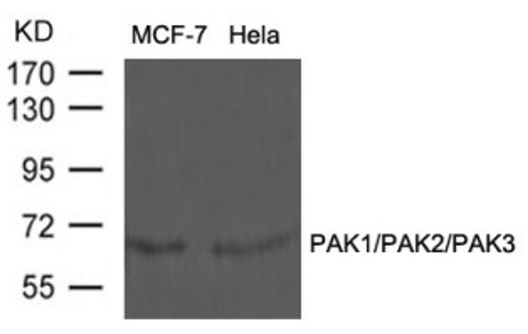 Western blot analysis of lysed extracts from MCF-7 and HeLa cells using PAK1/PAK2/PAK3 (Ab-423/402/421).