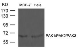 Western blot analysis of lysed extracts from MCF-7 and HeLa cells using PAK1/PAK2/PAK3 (Ab-423/402/421).