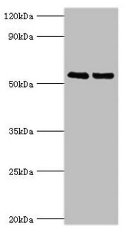 Western blot. All lanes: TRIM27 antibody at 4µg/ml. Lane 1: Jurkat whole cell lysate. Lane 2: HepG2 whole cell lysate. Secondary. Goat polyclonal to rabbit IgG at 1/10000 dilution. Predicted band size: 59, 42 kDa. Observed band size: 59 kDa