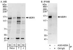 Detection of human MDR1/ABCB1 by western blot and immunoprecipitation.